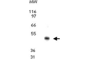 Western blot analysis for CCR10. (CCR10 Antikörper  (AA 350-362))