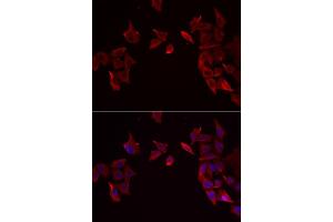Immunofluorescence analysis of MCF-7 cell using RAMP3 antibody. (RAMP3 Antikörper)