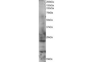 ABIN184568 staining (1µg/ml) of HeLa lysate (RIPA buffer, 35µg total protein per lane). (RAB2A Antikörper  (C-Term))