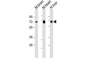 Western Blotting (WB) image for anti-Phosphoglucomutase 1 (PGM1) (AA 469-501) antibody (ABIN6242565)