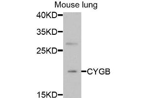 Western blot analysis of extracts of mouse lung, using CYGB antibody (ABIN6291140) at 1:1000 dilution. (CYGB Antikörper)