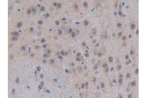 IHC-P analysis of Mouse Brain Tissue, with DAB staining. (p300 Antikörper  (AA 2124-2397))