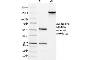 SDS-PAGE Analysis Purified CDC20 Mouse Monoclonal Antibody (AR12). (CDC20 Antikörper)