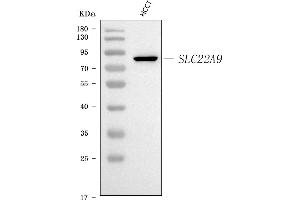 Western blot analysis of SLC22A9 using anti-SLC22A9 antibody (ABIN7603093).