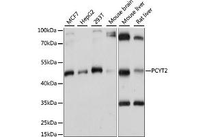 Western blot analysis of extracts of various cell lines, using PCYT2 antibody (ABIN7269277) at 1:1000 dilution. (PCYT2 Antikörper  (AA 1-389))