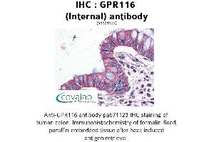 Image no. 1 for anti-G Protein-Coupled Receptor 116 (GPR116) (Internal Region) antibody (ABIN1734909) (G Protein-Coupled Receptor 116 Antikörper  (Internal Region))