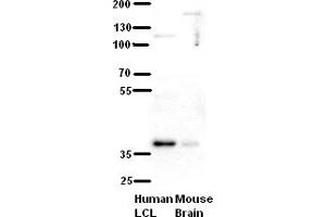 WB Suggested Anti-C21orf59 Antibody Titration:  5% Milk  ELISA Titer:  dilution: 1:500  Positive Control:  human LCL and mouse brains (C21orf59 Antikörper  (N-Term))