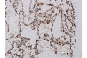 Immunoperoxidase of monoclonal antibody to FOXL1 on formalin-fixed paraffin-embedded human lung. (FOXL1 Antikörper  (AA 132-240))
