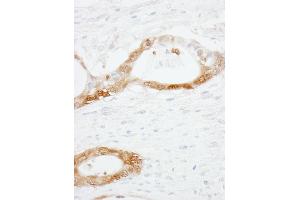 anti-Cellular Retinoic Acid Binding Protein 2 (CRABP2) (C-Term) antibody
