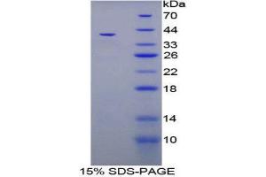 SDS-PAGE (SDS) image for Trefoil Factor 3 (Intestinal) (TFF3) (AA 22-80) protein (His tag,GST tag) (ABIN1879733)