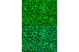 Immunofluorescence analysis of U2OS cells using DN antibody (ABIN6127820, ABIN6139729, ABIN6139731 and ABIN6224283) at dilution of 1:100. (DNAL1 Antikörper  (AA 41-190))