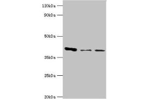 Western blot All lanes: E3 Ribonucleoside-diphosphate reductase subunit M2 B antibody at 6 μg/mL Lane 1: MCF-7 whole cell lysate Lane 2: Hela whole cell lysate Lane 3: HepG2 whole cell lysate Secondary Goat polyclonal to rabbit IgG at 1/10000 dilution Predicted band size: 41, 35, 16, 8, 5, 49 kDa Observed band size: 41 kDa (RRM2B Antikörper  (AA 1-351))