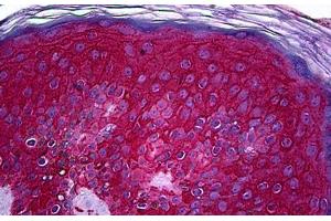 Human Skin: Formalin-Fixed, Paraffin-Embedded (FFPE) (KIT Antikörper  (AA 41-140))