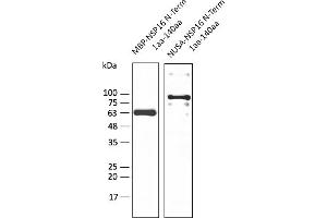 Western Blotting (WB) image for anti-SARS-CoV-2 2'-O-Ribose Methyltransferase (NSP16) (N-Term) antibody (ABIN7273008) (SARS-CoV-2 NSP16 Antikörper  (N-Term))