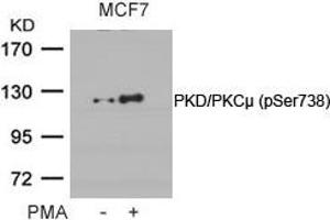 Western blot analysis of extracts from MCF cells untreated or treated with PMA using PKD/PKCm(Phospho-Ser738) Antibody. (PKC mu Antikörper  (pSer738))
