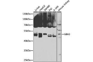 Western blot analysis of extracts of various cell lines, using GB antibody (ABIN6131369, ABIN6140990, ABIN6140991 and ABIN6223796) at 1:1000 dilution. (GBA3 Antikörper  (AA 1-162))
