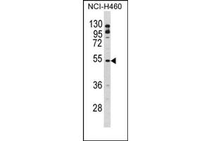 Image no. 1 for anti-B-Cell Linker (BLNK) (Middle Region) antibody (ABIN452784) (B-Cell Linker Antikörper  (Middle Region))