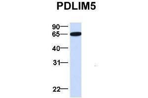 Host:  Rabbit  Target Name:  PDLIM5  Sample Type:  Human Fetal Brain  Antibody Dilution:  1. (PDLIM5 Antikörper  (N-Term))