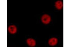 ABIN6269312 staining HeLa by IF/ICC. (MEF2A Antikörper  (Internal Region))