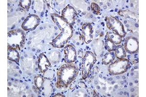 Image no. 1 for anti-Cadherin 1, Type 1, E-Cadherin (Epithelial) (CDH1) antibody (ABIN1497941) (E-cadherin Antikörper)