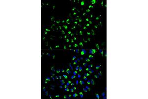 Immunofluorescence analysis of A549 cells using AK4 antibody (ABIN6290046). (AK4 Antikörper)