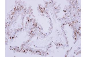 IHC-P Image Immunohistochemical analysis of paraffin-embedded OVCA xenograft, using CD75, antibody at 1:500 dilution. (ST6GAL1 Antikörper  (Center))