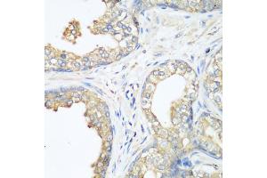 Immunohistochemistry of paraffin-embedded human prostate using CBL antibody (ABIN1871485) at dilution of 1:200 (40x lens).
