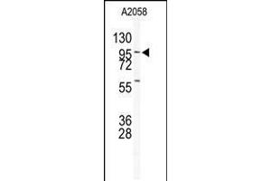 Western blot analysis of anti-USP5 Antibody in A2058 cell line lysates (35ug/lane) (USP5 Antikörper  (N-Term))