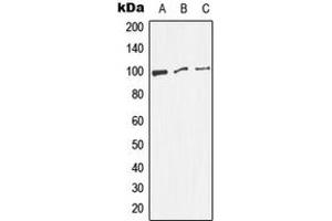 Western blot analysis of Dynamin 1 (pS774) expression in HeLa (A), NIH3T3 (B), PC12 (C) whole cell lysates. (Dynamin 1 Antikörper  (C-Term, pSer774))