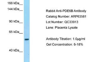 Western Blotting (WB) image for anti-phosphodiesterase 6B, CGMP-Specific, Rod, beta (PDE6B) (N-Term) antibody (ABIN971369) (PDE6B Antikörper  (N-Term))