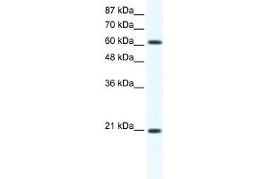 WB Suggested Anti-Anxa6 Antibody Titration:  1.