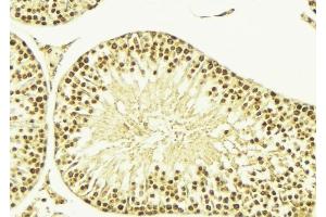ABIN6269376 at 1/100 staining Mouse testis tissue by IHC-P. (CAMK4 Antikörper  (Internal Region))