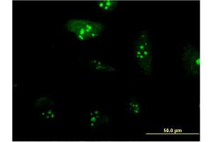 Immunofluorescence of monoclonal antibody to RPL23A on HeLa cell.