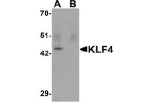 Image no. 1 for anti-Kruppel-Like Factor 4 (Gut) (KLF4) (C-Term) antibody (ABIN1449394) (KLF4 Antikörper  (C-Term))