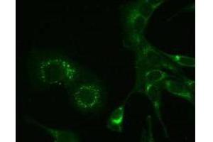 Immunofluorescence microscopy using Immunochemical anti-MHV-A59 nsp9 antibody, 6-h post infection in mouse L cells. (MHV NSP9 Antikörper)