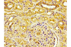 IHC image of ABIN7147154 diluted at 1:100 and staining in paraffin-embedded human kidney tissue performed on a Leica BondTM system. (CD31 Antikörper  (AA 28-315))