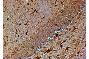 ABIN184611 (4µg/ml) staining of paraffin embedded Mouse Hippocampus. (TRPM7 Antikörper  (C-Term))