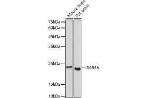 Western blot analysis of extracts of various cell lines, using RA antibody (ABIN3021646, ABIN3021647, ABIN3021648 and ABIN1513457) at 1:500 dilution. (RAB5 Antikörper  (AA 1-215))