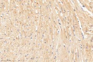 Immunohistochemistry analysis of paraffin-embedded mouse heart using,MTND1 (ABIN7074658) at dilution of 1: 1000 (MT-ND1 Antikörper)