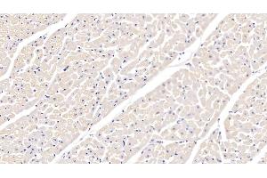 Detection of ITGa5 in Bovine Cardiac Muscle Tissue using Polyclonal Antibody to Integrin Alpha 5 (ITGa5) (ITGA5 Antikörper  (AA 649-900))