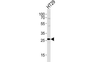Western Blotting (WB) image for anti-Nicotinamide N-Methyltransferase (NNMT) antibody (ABIN2997531) (NNMT Antikörper)