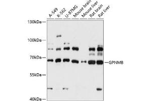 Western blot analysis of extracts of various cell lines, using GPNMB antibody (ABIN7269117) at 1:3000 dilution. (Osteoactivin Antikörper  (AA 22-260))