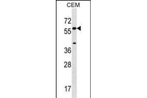 Western Blotting (WB) image for anti-Cytochrome P450, Family 21, Subfamily A, Polypeptide 2 (CYP21A2) (AA 160-188) antibody (ABIN1537905)