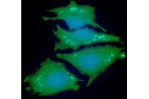 ICC/IF analysis of NDRG1 in HeLa cells line, stained with DAPI (Blue) for nucleus staining and monoclonal anti-human NDRG1 antibody (1:100) with goat anti-mouse IgG-Alexa fluor 488 conjugate (Green).