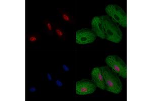 ABIN6257258 and ABIN6274281 staining  cells by IF/ICC. (HNRNPF Antikörper  (N-Term))