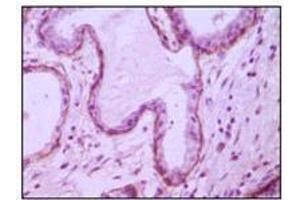 Immunohistochemical analysis of paraffin-embedded human breast ductal myoepithelium,showing cytoplasmic and membrane location with DAB staining using CD10 mouse mAb. (MME Antikörper)