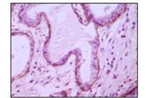 Immunohistochemical analysis of paraffin-embedded human breast ductal myoepithelium,showing cytoplasmic and membrane location with DAB staining using CD10 mouse mAb.