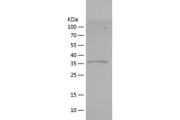 MSTN Protein (AA 267-375) (His-IF2DI Tag)