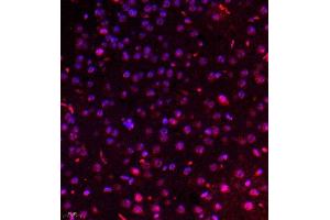 Immunofluorescence of paraffin embedded mouse brain using USP34 (ABIN7076115) at dilution of 1:700 (400x lens)