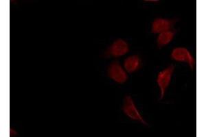 Immunofluorescence (fixed cells) (IF/ICC) image for anti-Spleen tyrosine Kinase (SYK) (pTyr323) antibody (ABIN6256708)